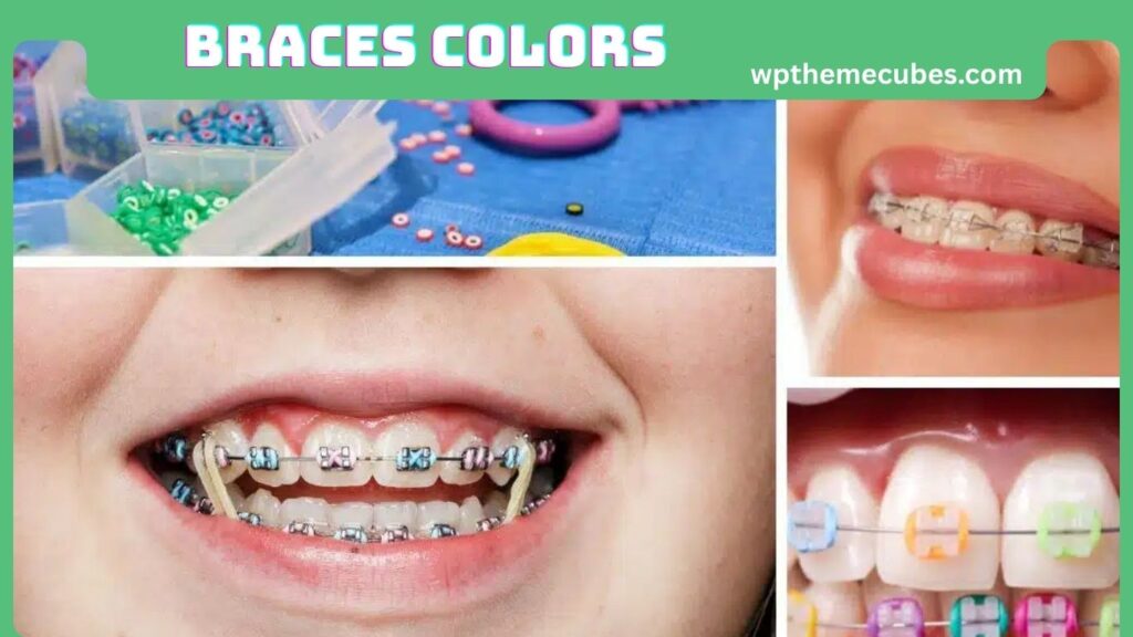 Braces Colors